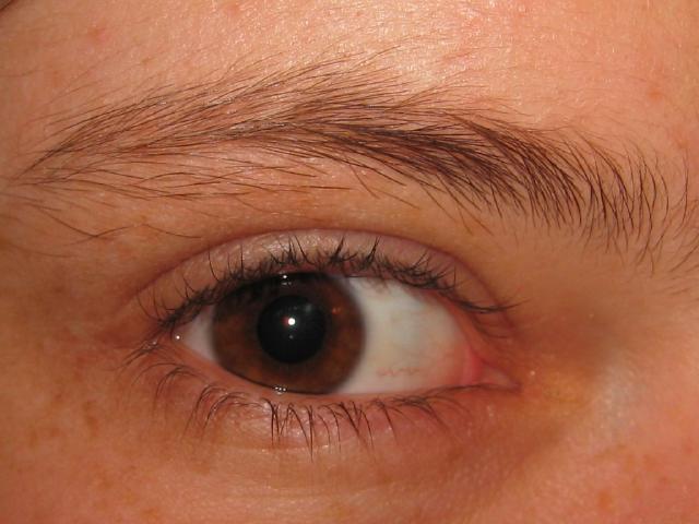 034175_Patricias_Auge.jpg