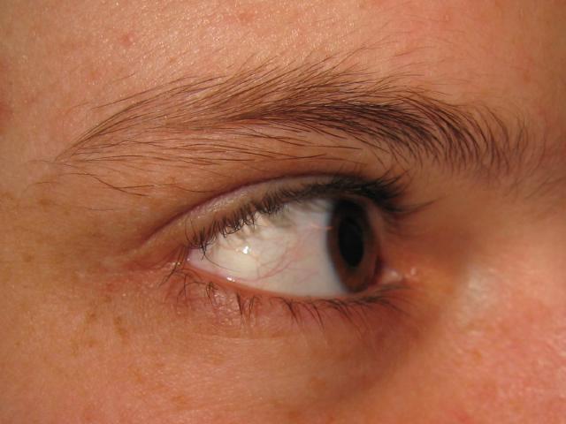 034178_Patricias_Auge.jpg